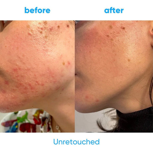 REBELS REFINERY 100% NATURAL FACE WASH 100 ML - Purple Beauty Supplies