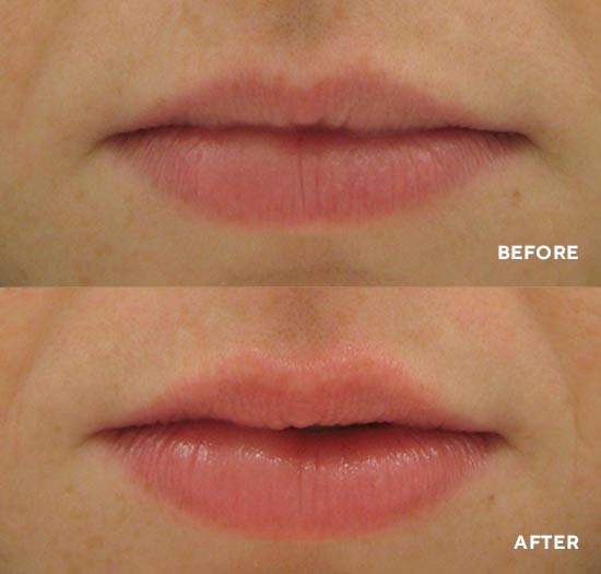 HYDROPEPTIDE PERFECTING GLOSS - SUN-KISSED .17 OZ/ 5 ML - Purple Beauty Supplies