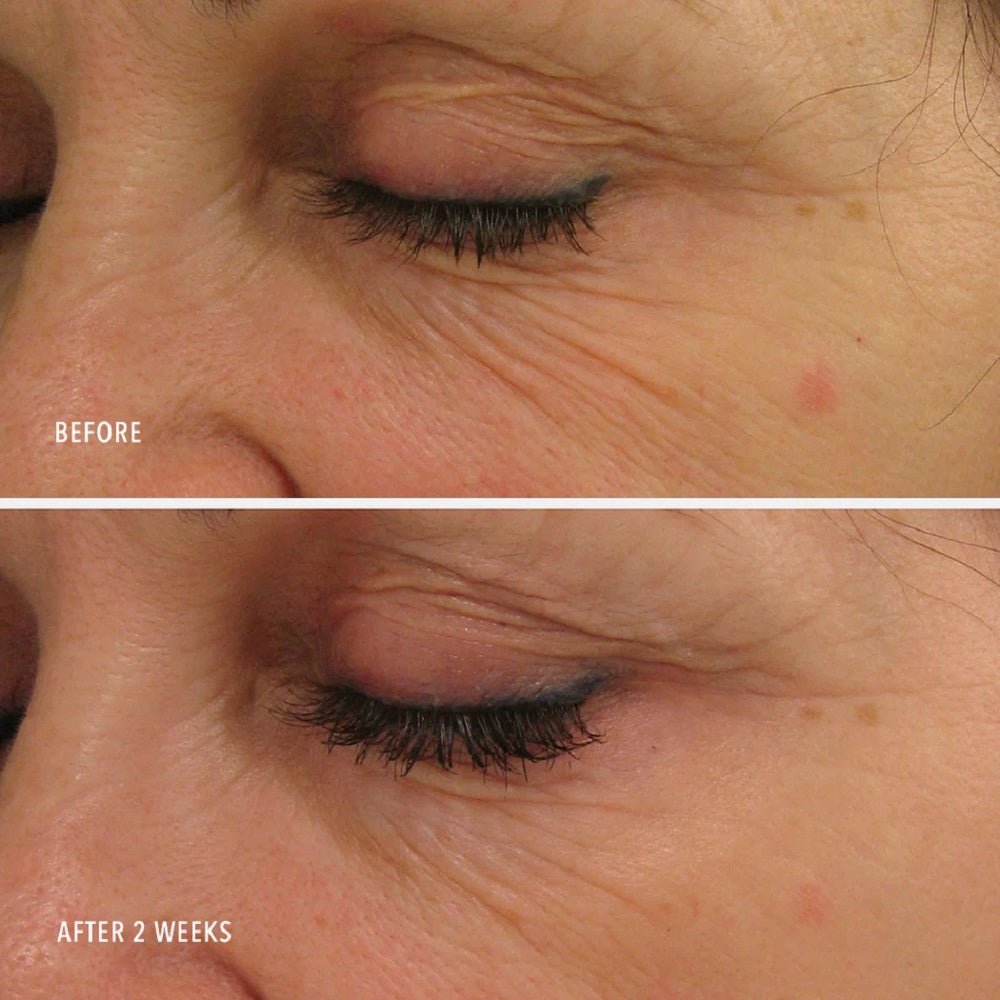 HYDROPEPTIDE LINE LIFTING POWER SERUM 1 OZ / 30 ML - Purple Beauty Supplies