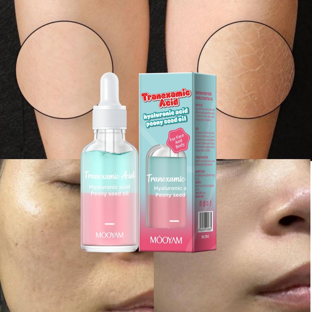 MOOYAM TRANEXAMIC ACID | HYALURONIC ACID & PEONY SEED OIL 30ML - Purple Beauty Supplies